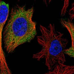 IFIT1 Antibody, Novus Biologicals 0.1mL; Unlabeled:Antibodies, Polyclonal